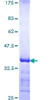 SDS-PAGE - Recombinant Human Cyclin T1 protein (GST tag N-Terminus) (AB152261)