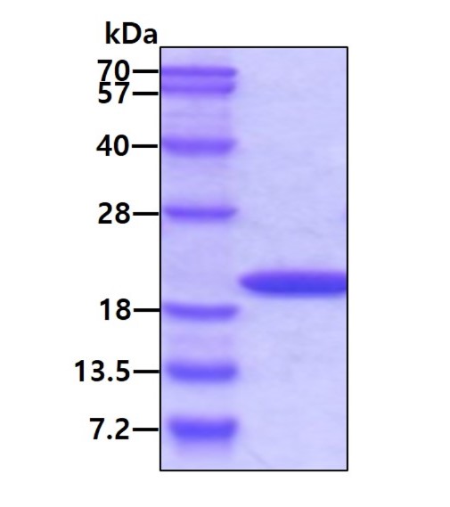 SDS-PAGE - Recombinant human Cyclophilin A protein (Active) (AB86219), expandable thumbnail