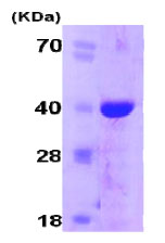 SDS-PAGE - Recombinant Human Cyclophilin E protein (AB78843), expandable thumbnail