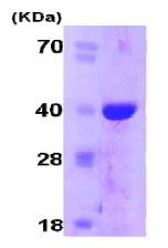 SDS-PAGE - Recombinant Human Cyclophilin E protein (His tag N-Terminus) (AB78843)