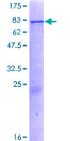 SDS-PAGE - Recombinant Human CYP11A1 protein (AB132669)