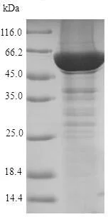 SDS-PAGE - Recombinant Human CYP21A2 protein (His tag) (AB225641)