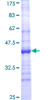 SDS-PAGE - Recombinant Human CYP24A1 protein (AB152322)