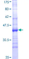 SDS-PAGE - Recombinant Human CYP24A1 protein (GST tag N-Terminus) (AB152322)