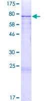 SDS-PAGE - Recombinant Human CYP27A1 protein (AB158258)