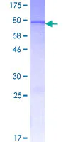 SDS-PAGE - Recombinant Human CYP2A13 protein (AB158247)