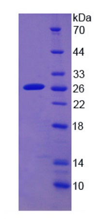 SDS-PAGE - Recombinant Human CYP2D6 protein (His tag) (AB275567), expandable thumbnail