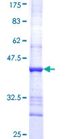 Recombinant Human CYP51A1/CYP51 protein