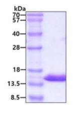 Recombinant human Cystatin A protein (Active)