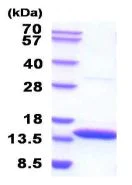 SDS-PAGE - Recombinant human Cystatin-B protein (His tag N-Terminus) (AB211315)