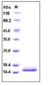 SDS-PAGE - Recombinant Human Cystatin D protein (His tag) (AB276283)