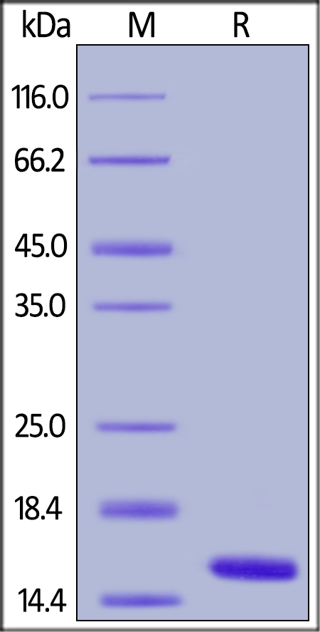 SDS-PAGE - Recombinant human Cystatin SA/CST2 protein (AB180061), expandable thumbnail