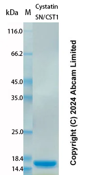 SDS-PAGE - Recombinant Human Cystatin SN/CST1 Protein Standard (His tag) (AB323016)