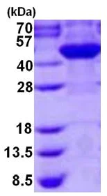 SDS-PAGE - Recombinant Human Cyt 19 protein (AB126694)