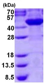 SDS-PAGE - Recombinant Human Cyt 19 protein (His tag N-Terminus) (AB126694)