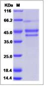 SDS-PAGE - Recombinant Human CYTL1 protein (Fc Chimera) (AB276570)