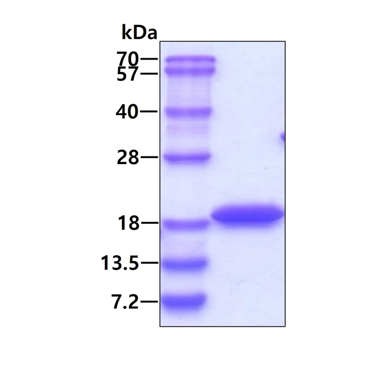 SDS-PAGE - Recombinant Human Cytochrome b5 protein (His tag) (AB264452)