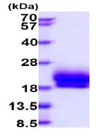 SDS-PAGE - Recombinant Human Cytochrome b5 protein (His tag C-Terminus) (AB235880)