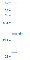 SDS-PAGE - Recombinant Human Cytochrome C Oxidase subunit VIc/COX6C protein (GST tag N-Terminus) (AB158177)