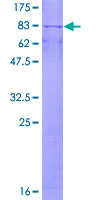 SDS-PAGE - Recombinant Human Cytochrome P450 17A1/CYP17A1 protein (GST tag N-Terminus) (AB152320)