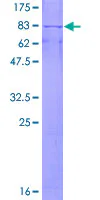 SDS-PAGE - Recombinant Human Cytochrome P450 17A1/CYP17A1 protein (GST tag N-Terminus) (AB152320)
