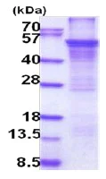 SDS-PAGE - Recombinant Human Cytochrome P450 2E1 protein (denatured) (His tag N-Terminus) (AB202203)