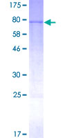 SDS-PAGE - Recombinant Human Cytochrome P450 3A4/CYP3A4 protein (AB114327), expandable thumbnail