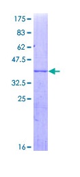 SDS-PAGE - Recombinant Human Cytochrome P450 3A4/CYP3A4 protein (AB114328)