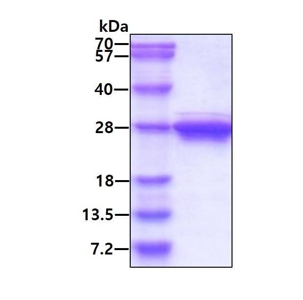 SDS-PAGE - Recombinant Human Cytoglobin protein (His tag N-Terminus) (AB97347)