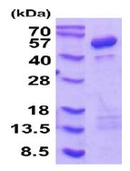 SDS-PAGE - Recombinant Human Cytohesin 1 protein (AB202206)