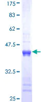 SDS-PAGE - Recombinant Human Cytokeratin 1 protein (AB114282)