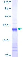 SDS-PAGE - Recombinant Human Cytokeratin 1 protein (GST tag N-Terminus) (AB114282)