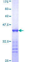 SDS-PAGE - Recombinant Human Cytokeratin 10 protein (AB114223)