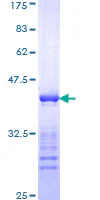 SDS-PAGE - Recombinant Human Cytokeratin 10 protein (GST tag N-Terminus) (AB114223)
