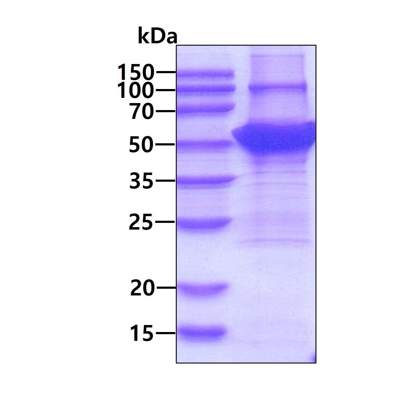 SDS-PAGE - Recombinant Human Cytokeratin 14 protein (His tag N-Terminus) (AB264453)