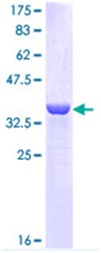 SDS-PAGE - Recombinant Human Cytokeratin 16/K16 protein (AB114405)