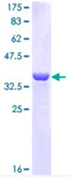 SDS-PAGE - Recombinant Human Cytokeratin 16/K16 protein (GST tag N-Terminus) (AB114405)