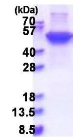 SDS-PAGE - Recombinant Human Cytokeratin 17 protein (denatured) (His tag N-Terminus) (AB177718)