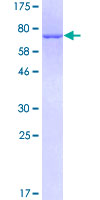 SDS-PAGE - Recombinant Human Cytokeratin 17 protein (AB116974)