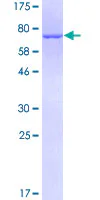 SDS-PAGE - Recombinant Human Cytokeratin 17 protein (GST tag N-Terminus) (AB116974)