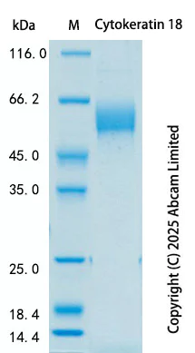 SDS-PAGE - Recombinant Human Cytokeratin 18 Fragment (CK18-30) Protein Standard (AB324403)