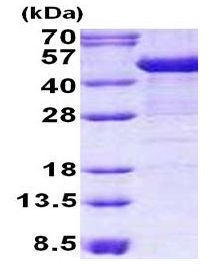 SDS-PAGE - Recombinant Human Cytokeratin 19 protein (denatured) (His tag N-Terminus) (AB140055)
