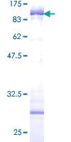 SDS-PAGE - Recombinant Human Cytokeratin 5 protein (AB132931)