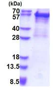 SDS-PAGE - Recombinant Human Cytokeratin 5 protein (denatured) (His tag N-Terminus) (AB180285)