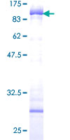 SDS-PAGE - Recombinant Human Cytokeratin 5 protein (GST tag N-Terminus) (AB132931)