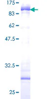 SDS-PAGE - Recombinant Human Cytokeratin 5 protein (GST tag N-Terminus) (AB132931)