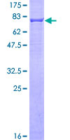 SDS-PAGE - Recombinant Human Cytokeratin 6a protein (GST tag N-Terminus) (AB158802)
