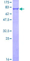 SDS-PAGE - Recombinant Human Cytokeratin 6a protein (GST tag N-Terminus) (AB158802)