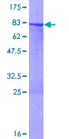 SDS-PAGE - Recombinant Human Cytokeratin 7 protein (GST tag N-Terminus) (AB132933)