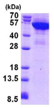 SDS-PAGE - Recombinant Human Cytokeratin 8 protein (AB156970)